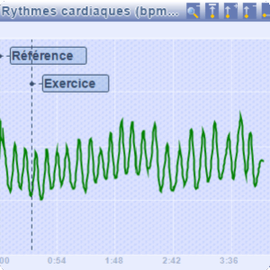 Tachogramme : courbe du rythme cardiaque en cohérence